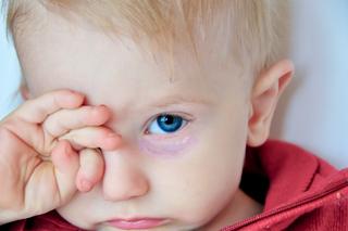 Sińce pod oczami u niemowlęcia i dziecka – skąd się biorą, czy są niebezpieczne?