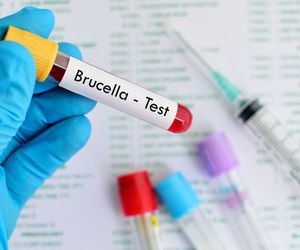 Bruceloza - choroba przenoszona przez zwierzęta