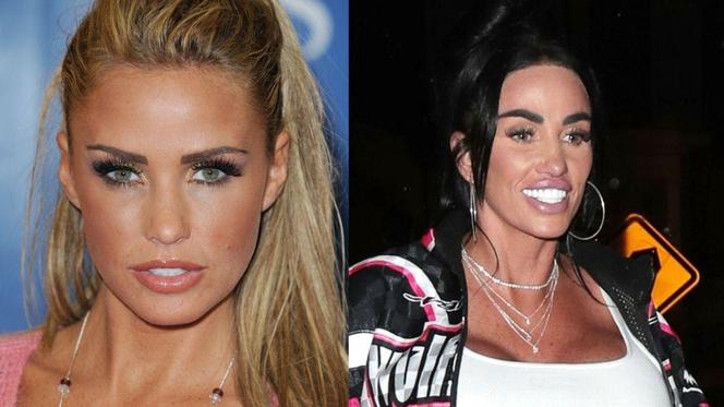 Katie Price poddaje się operacjom plastycznym od 25 lat! Tak się zmieniła