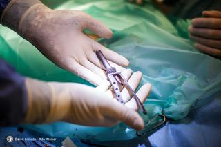 Dostał łapę z drukarki 3d