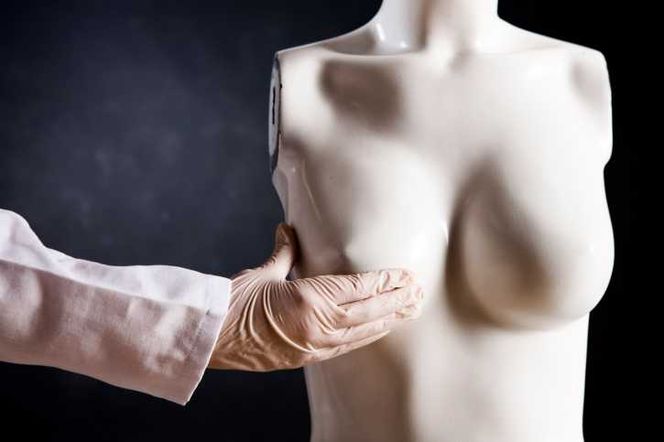 Rodzaje mastektomii: prosta amputacja piersi