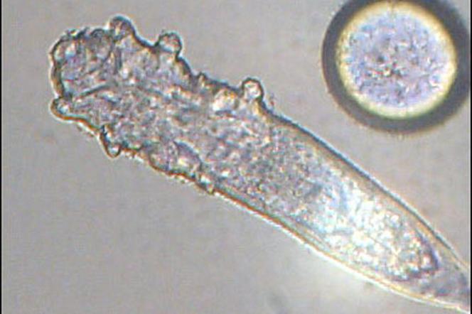 Nużeniec ludzki pod mikroskopem
