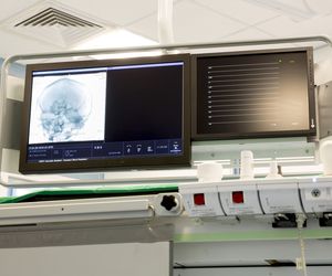 Wyściółczaki (ependymoma): przyczyny, objawy, leczenie