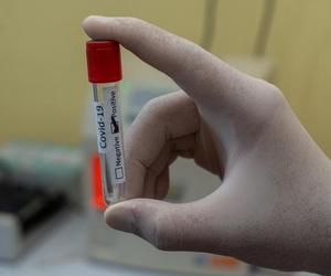 Ogromne zainteresowanie testami na grypę, covid i RSV, brakuje leków i antybiotyków