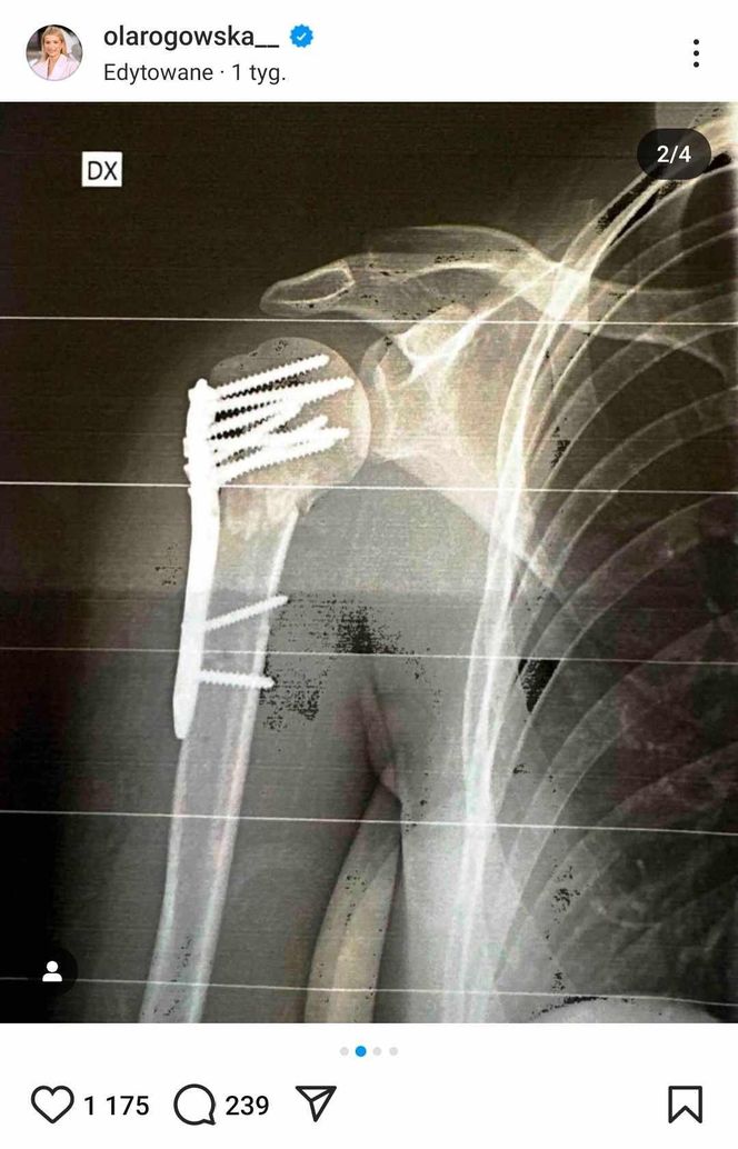 Aleksandra Rogowska-Lichnerowicz