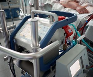 ECMO - co to jest? Wskazania, zastosowanie w medycynie