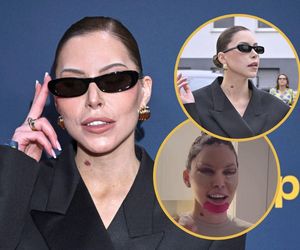 29-letnia Julia von Stein pokazała nową twarz. Pierwsze wyjście po liftingu. Warto było iść pod nóż?