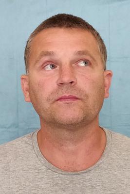 Wydrukowali mu nowe kości twarzy