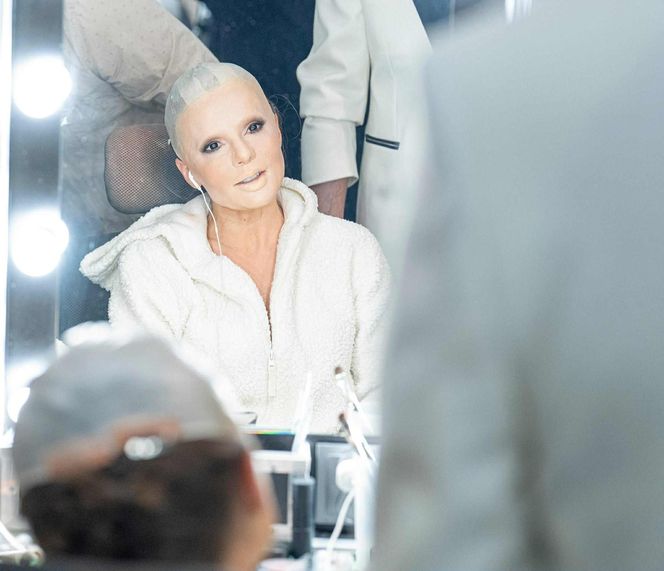 Edyta Herbuś - łysa śpiewaczka