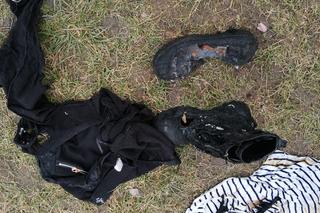 Matka z córką zostały poparzone 