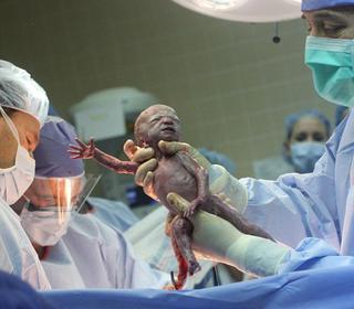 Jak wygląda dziecko po porodzie - ZDJĘCIA - w Wielkiej Brytanii urodziły się sześcioraczki