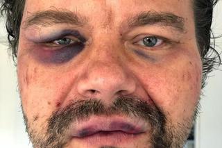 Pobili dziennikarza GW