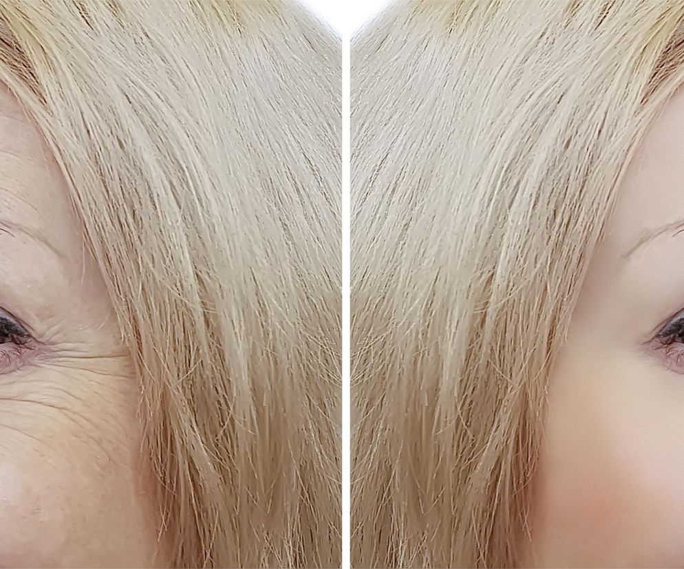 Ten krem obudzi skórę wokół oczu. Pożegnasz worki, cienie i kurze łapki