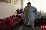 Ta kobieta waży ponad 300 kg! Szoruje fałdy tłuszczu na nogach szczotką do mycia pleców! [ZDJĘCIA]