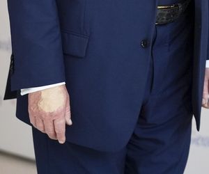 Donald Trump ma kłopoty ze zdrowiem. Nowe zdjęcia wywołały niepokój