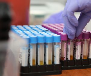 Ostrów. Laboratorium w szpitalu po remoncie! 