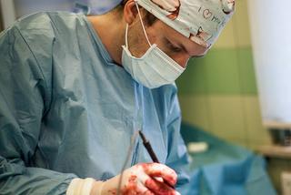 Dostał łapę z drukarki 3d