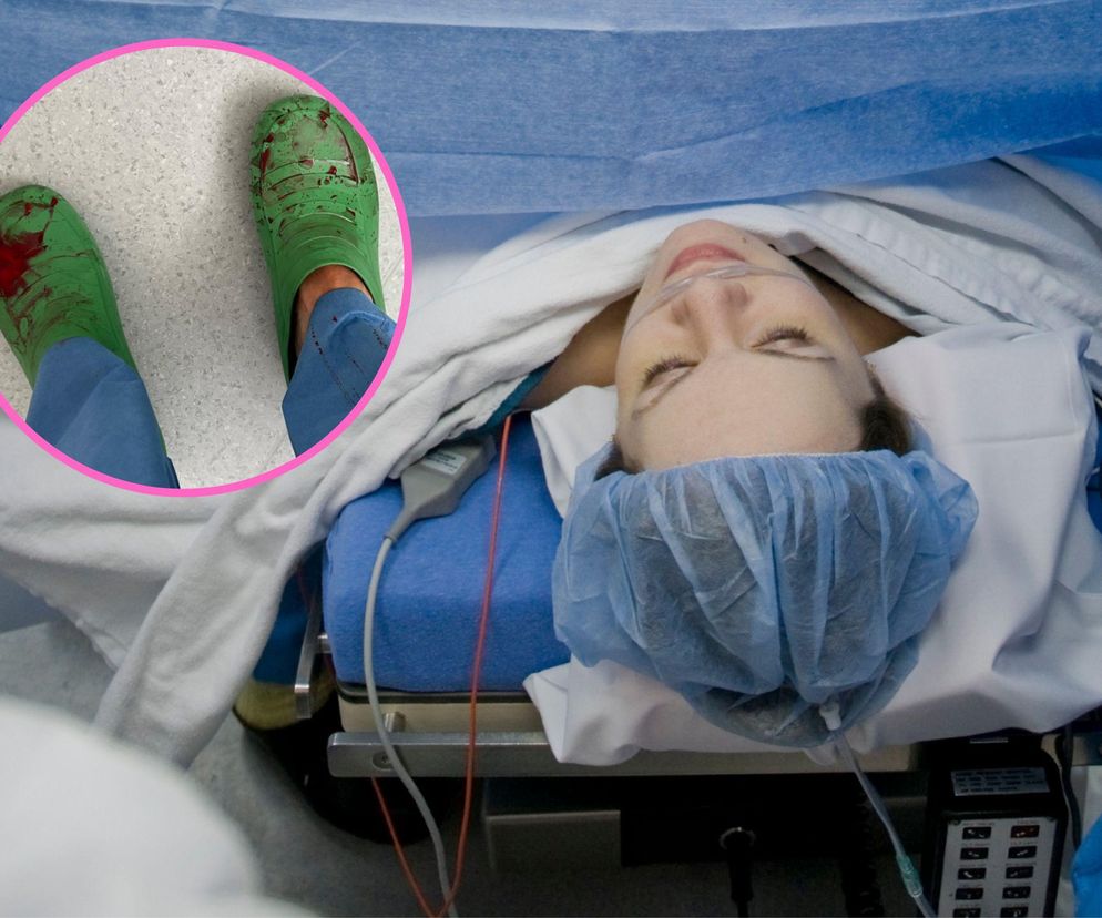 Ginekolog pokazuje swoje zdjęcie po cesarce. Niech uświadomi że to nie jest mała operacja 