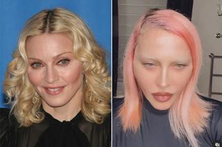 Szok! Madonna ma nową twarz! Nie sposób jej poznać. Chirurg ujawnia, co zrobiła