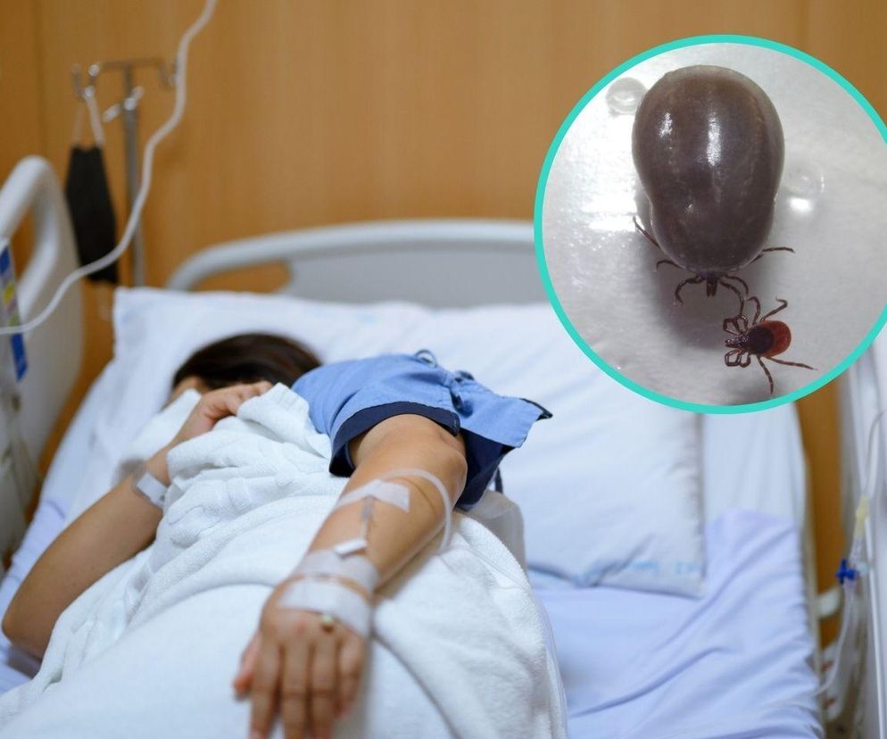 Pierwszy chory z kleszczowym zapaleniem mózgu. „Kleszcze są niebezpieczne cały rok”