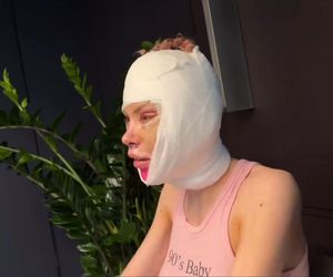 Julia Von Stein po operacji 