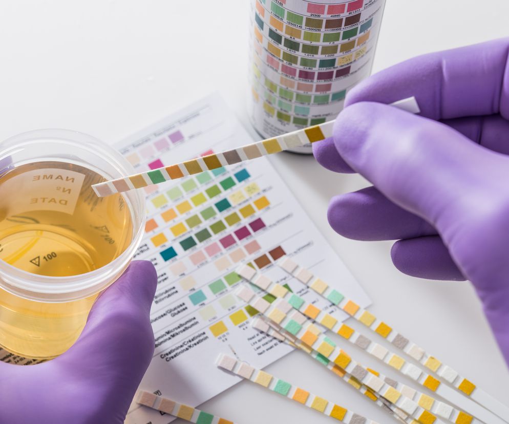 Bakterie w moczu (bakteriomocz) - przyczyny i leczenie