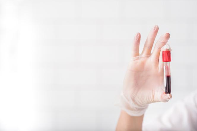 Morfologia i OB - BADANIA KRWI, czyli co się mieści w kropli krwi