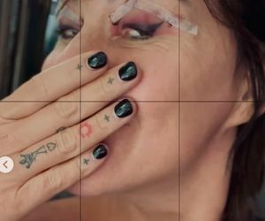 Katarzyna Skowrońska przeszła operację plastyczną