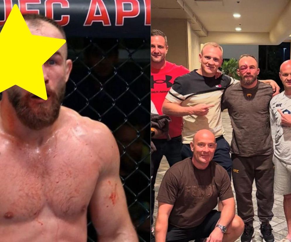 Krwawa masakra w walce Mateusza Rębeckiego w UFC. Pokazał zdjęcie po pojedynku