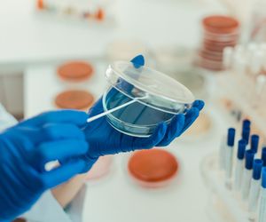 Ropień, ropniak, ropowica – czym różnią się zakażenia ropne?