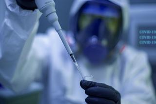 Naukowcy GUMed zbadają wypalenie zawodowe diagnostów w czasie pandemii. Udział w badaniu jest dobrowolny