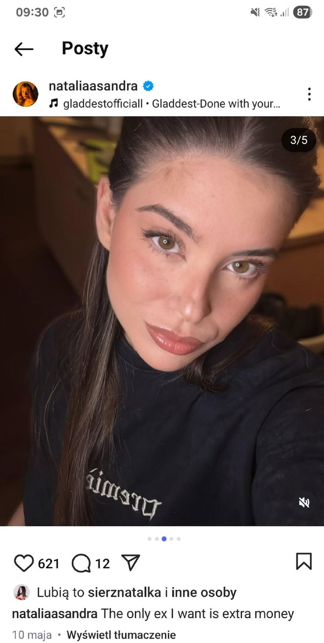 Natalia Zambrzycka (Agata z serialu Barwy szczęścia) powiększa sobie usta od lat