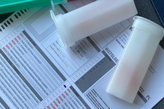 Sercowe problemy Czarnego [GALERIA]