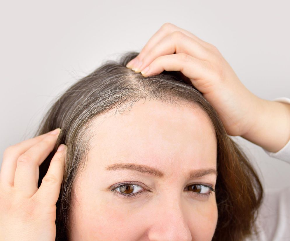 Przetłuszczają się, siwieją i wypadają. Niedobór tej witaminy to duży problem dla włosów