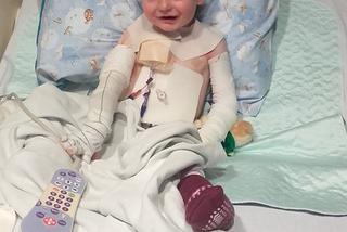 Moja skóra mnie zabija