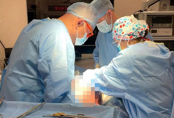 Ogromny guz jajnika usunięty w Centrum Onkologii w Bydgoszczy