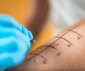 Testy alergiczne - wskazania, rodzaje, przebieg. Jak przebiegają testy na alergię?