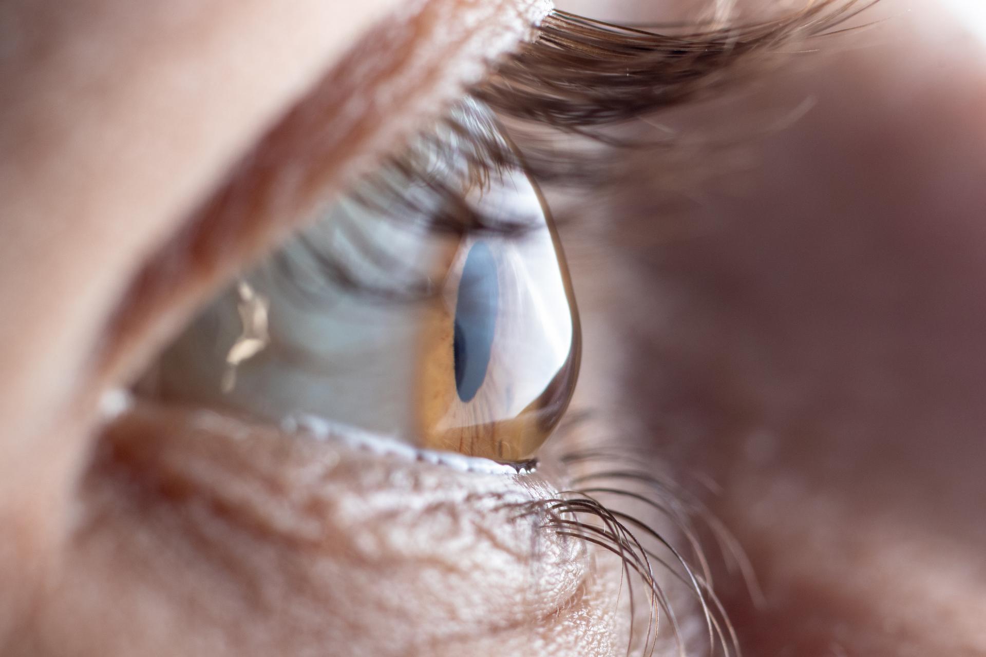 Choroby Oczu I Wady Wzroku Objawy Przyczyny I Leczenie