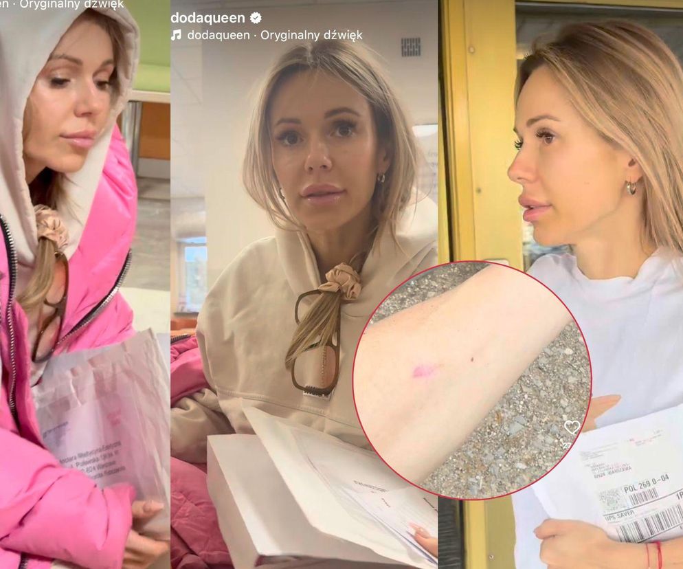Doda pokazała bliznę po wycięciu czerniaka