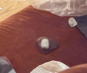 Atak nożownika w hotelu