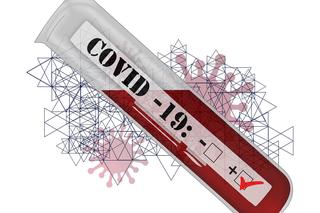 Koronawirus w DPS w Łaziskach - Ile osób jest zarażonych?