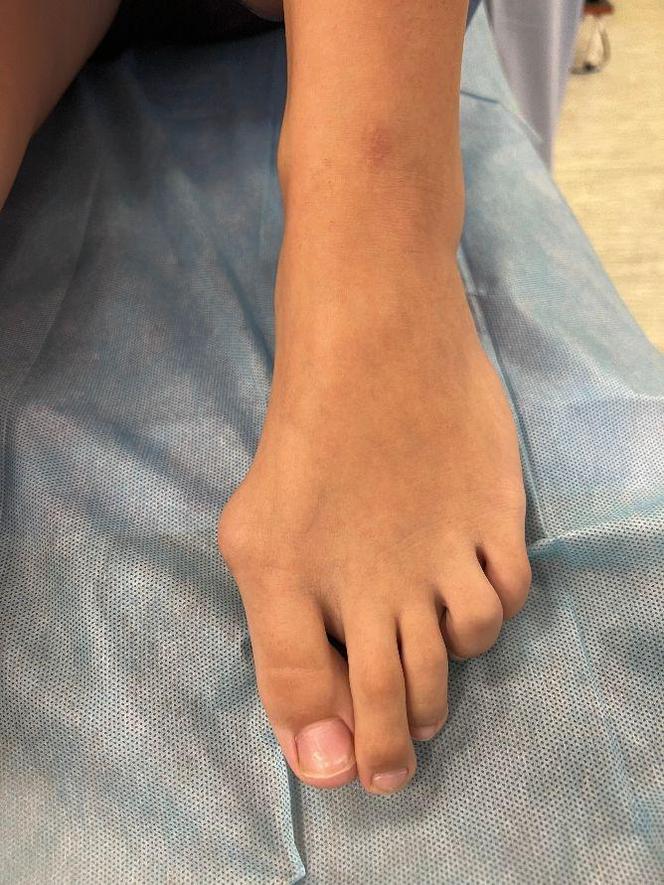 Chorzów. Innowacyjny zabieg u dziecka przeprowadzony po raz pierwszy na Śląsku