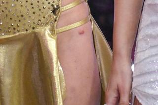 Posiniaczone nogi i porwane sukienki w TzG. Oto najgorsze wpadki