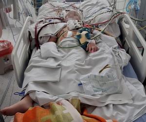 Gdańsk. Życie 6-letniego Aleksa uratowane. Inni lekarze nie dawali mu szans