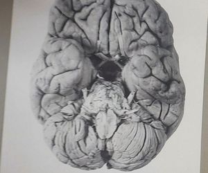 Tajemnica mózgu Piłsudskiego. Nieznany album w archiwach