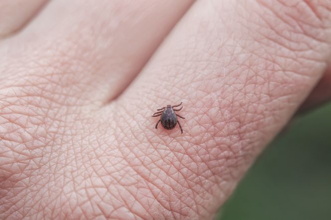 Kleszcze atakują na potęgę. Czy lekarz POZ skieruje na darmowe badania w kierunku boreliozy?