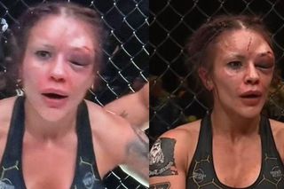 Zmasakrowana twarz zawodniczki PRIME MMA po walce. Porównali ją do... Joanny Jędrzejczyk [ZDJĘCIE]