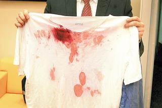 Wściekli policjanci skatowali Wiplera