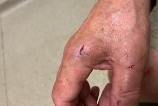 Były szef ZKP pogryziony przez trzy psy