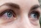 Boreliozę można zobaczyć w oczach? 5 objawów zdradza chorobę